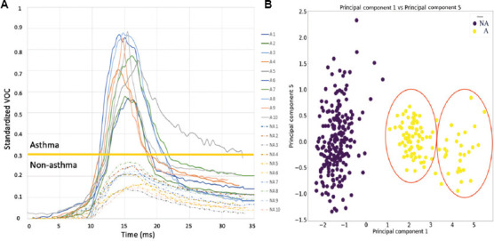 Interasma's tweet image. #Exhale-Dx™: A non-invasive, real-time #breath #analysis system using #deep #learning for #asthma #diagnosis. Open Access. interasma.org/2025/09/17/exh…