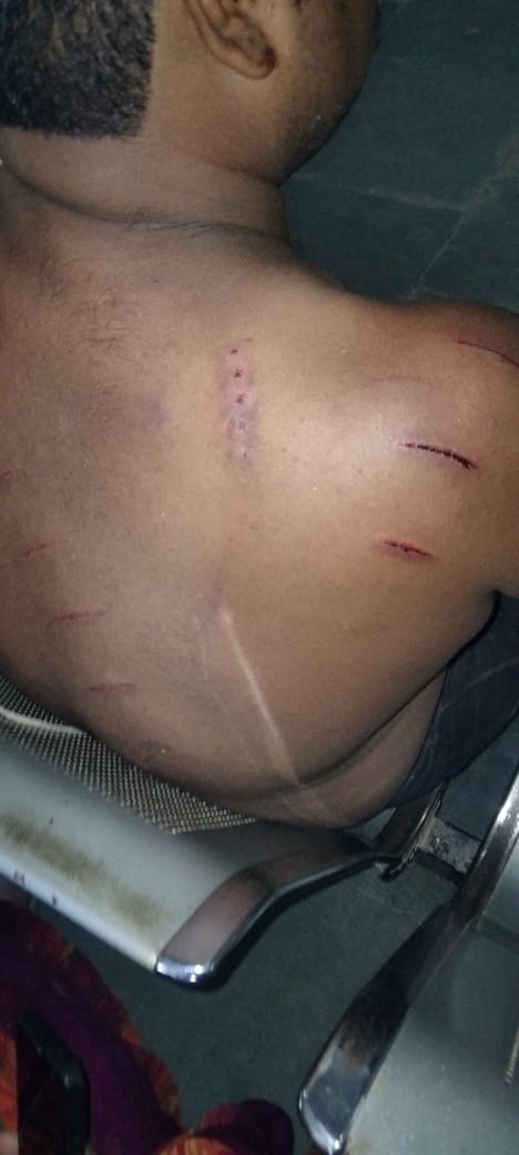 ब्राहमण ही तो है। मार दों फँसा दों ना तुम्हारी प्रसाशन सुनेगा ना शाशन ना ही कोई पार्टी ना कोई नेता -
पं राजकिशोर तिवारी ,कुलदीप तिवारी ,मोनू तिवारी ,शिवप्रकाश तिवारी ,कीमती वाजपई को <a href="/raebarelipolice/">Raebareli Police</a> के सामने कुल्हाड़ी से जानलेवा हमले किये <a href="/Uppolice/">UP POLICE</a> के मोबाइल तक छीन लियॆ पीड़ितों