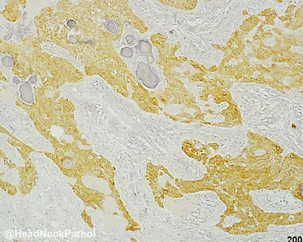 Head Neck Pathol tweet media