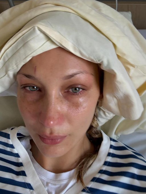 بيلا حديد تظهر باكية مجددا ووالدتها تثني على شجاعتها في محاربة المرض... اكتشفي تفاصيل القصة الكاملة 