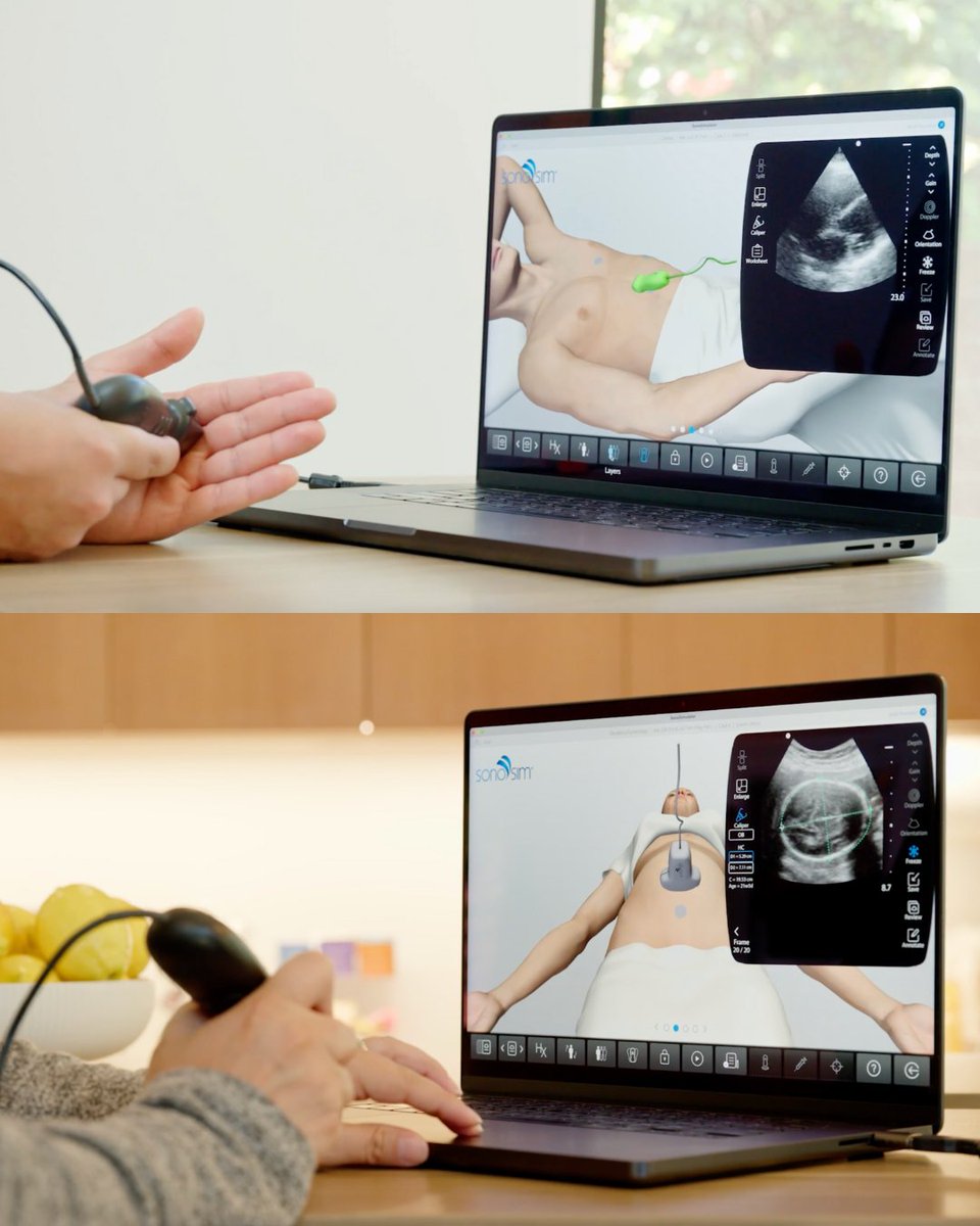 SonoSim's tweet image. This #hcsimweek, we appreciate being united through sim. 🌍✨

We’re proud to provide support for this movement by integrating U/S training into simulation, leveraging existing assets in the sim center, and making simulation even more engaging, accessible, and effective. 🤝