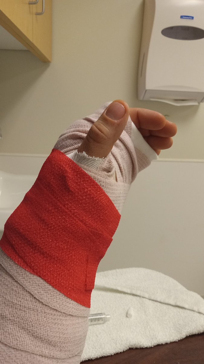 Alex Melee (@amelee8bit) on Twitter photo Year 2 truly put things in perspective for me. I have ventured to states and promotions I didn't think I would, and I am truly grateful. Even with injure setbacks, I feel Year 2 was better than the first. I'm ready for 2 more years, and 2 after that, etc. Year 2 truly put things in perspective for me. I have ventured to states and promotions I didn't think I would, and I am truly grateful. Even with injure setbacks, I feel Year 2 was better than the first. I'm ready for 2 more years, and 2 after that, etc.