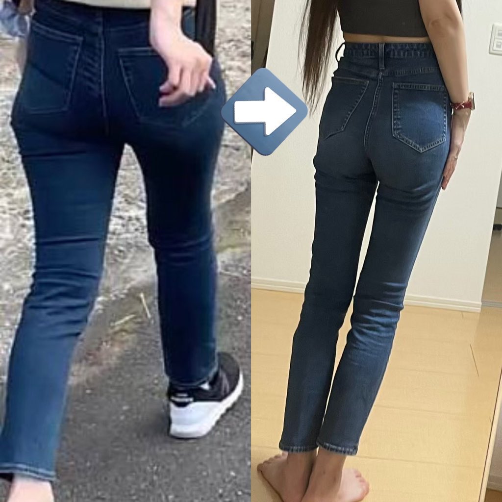 渡韓整形ビフォアフ
・抜歯矯正
・脂肪吸引
顔・二の腕・太もも・ふくらはぎ・お腹
・二重埋没2回→二重全切開
・輪郭3点
・フルフェイス切開リフト
・鼻フル→修正→修正仮予約済
・内側外側人中短縮
・口角挙上
・目の下脂肪再配置
・メンタースムース豊胸
・膣縮小ビラ切り
歯と埋没以外は韓国産🇰🇷