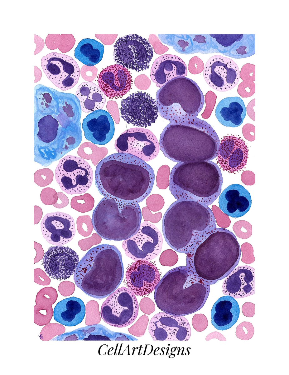 CML for #leukemiaawareness month. #pathx #pathart #pathology