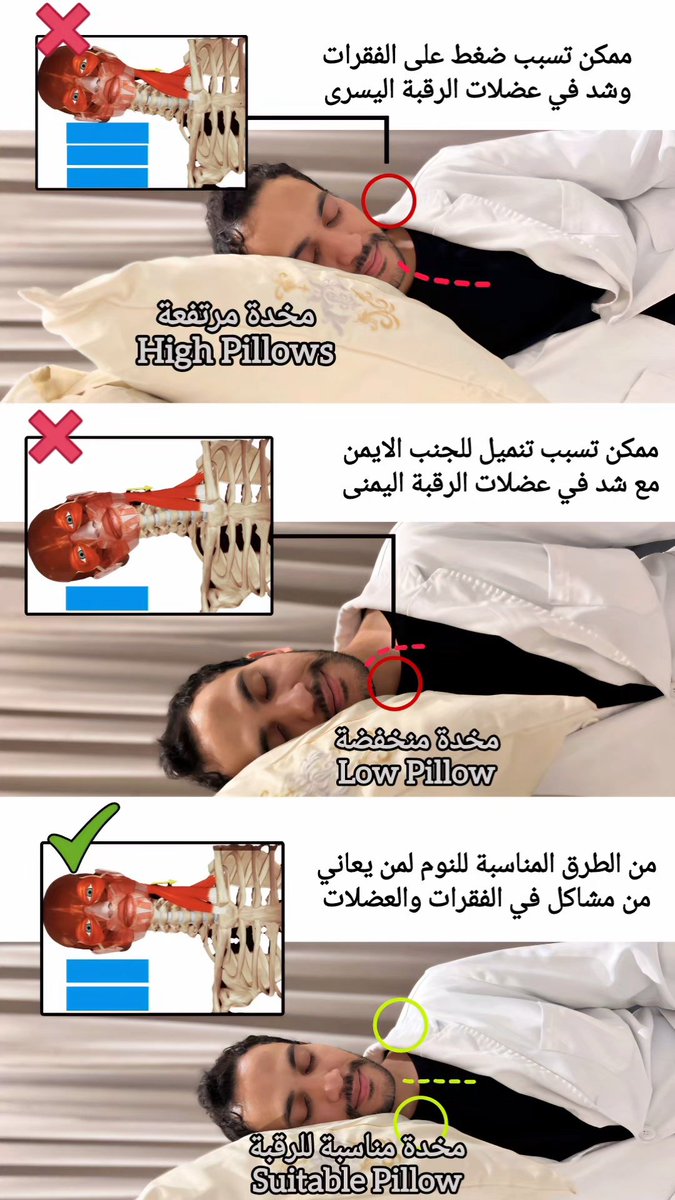 🔴 الم الرقبة والكتف ممكن يكون بسبب ارتفاع المخدة :