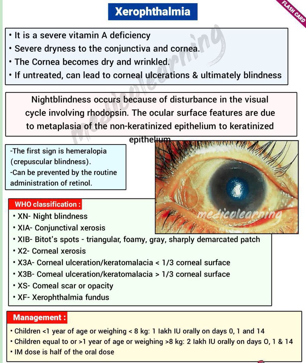 🔵 هل يمكن أن تتأثر العين من نقص الفيتامينات في الغذاء ؟

🔹نعم قد تتأثر العين وبالتالي قد يتأثر النظر وتحدث بعض المشاكل البصرية لكن في حالات محدودة 
فمثلًا ، نقص فيتامين A الشديد قد يتسبب بحدوث عمى ليلي وجفاف بالعين 

🔺للمختصين الراغبين بالإستزادة ⬇️

dovepress.com/association-be…
