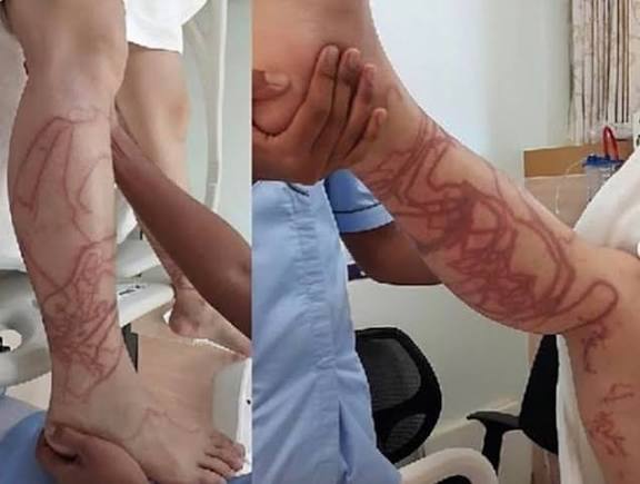 ulk_br's tweet photo. @AldoSterone111 Tu peux la prendre avec les doigts au niveau de la partie transparente mais surtout pas les filaments roses qui brûlent la peau. Au philippines il n'est pas rare de voir des gens avec des brûlures en forme de spaghetti sur jambes. https://t.co/BNMHqZrFZL