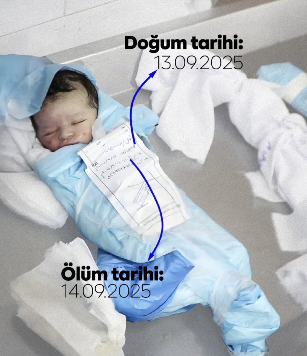 Dünya yıkılsın artık.

Gazze’de bir günlük bir bebek İsrail saldırısında katledildi.