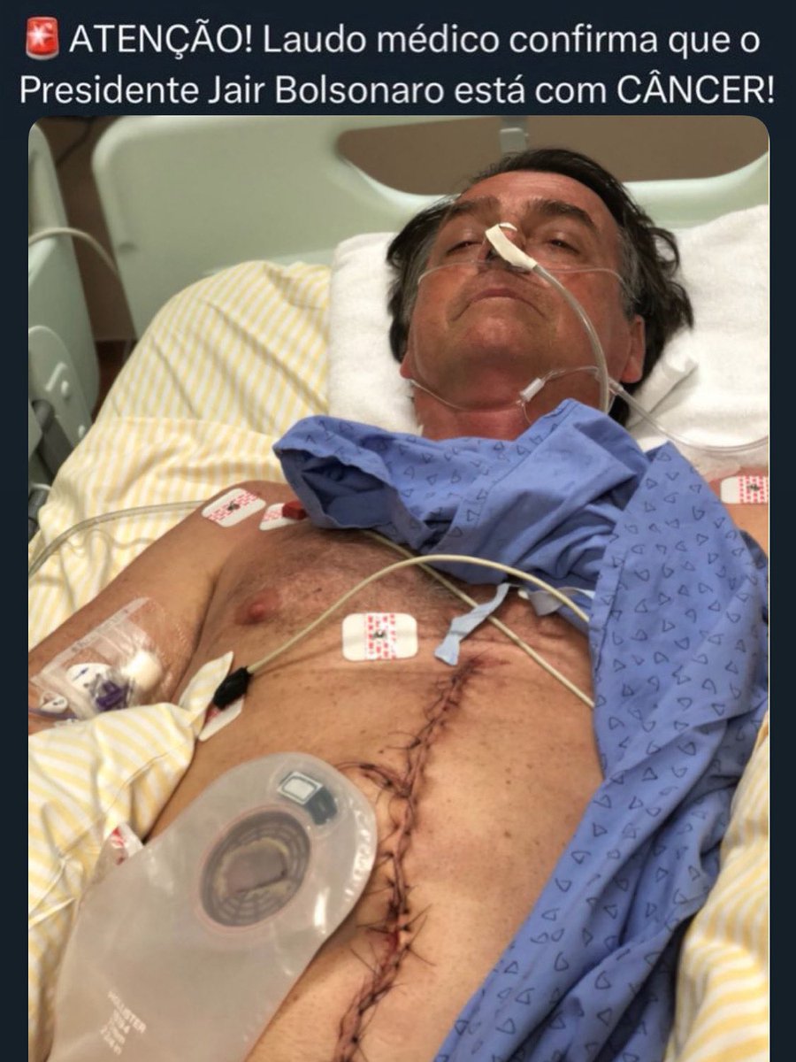 Depois de está sendo torturado fisicamente e psicologicamente pelo Estado Brasileiro, o presidente Bolsonaro agora enfrenta outra dura batalha, que é a luta contra o CÂNCER 😭😭😭😭

Que Deus restabeleça sua saúde presidente.

Tanta humilhação, tanta perseguição, tantos abusos