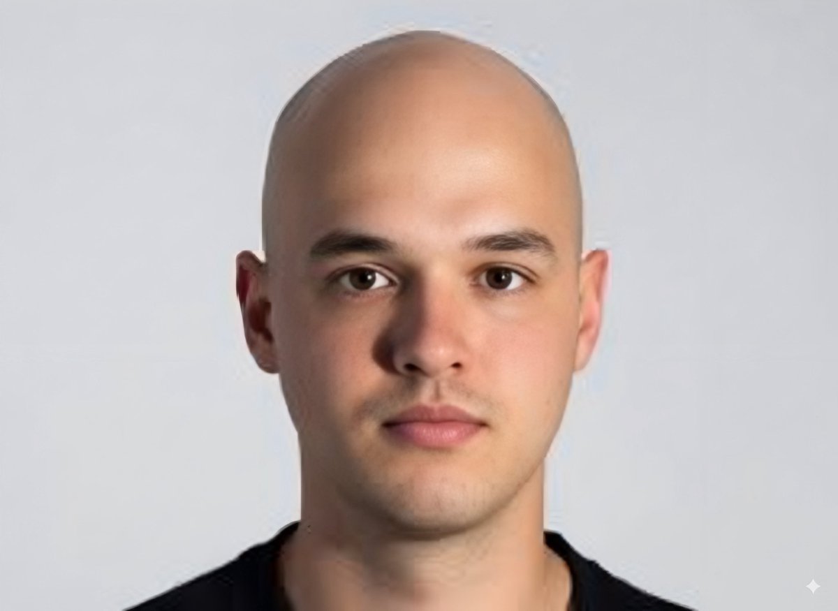 I agree. This is what's really under his cap😁