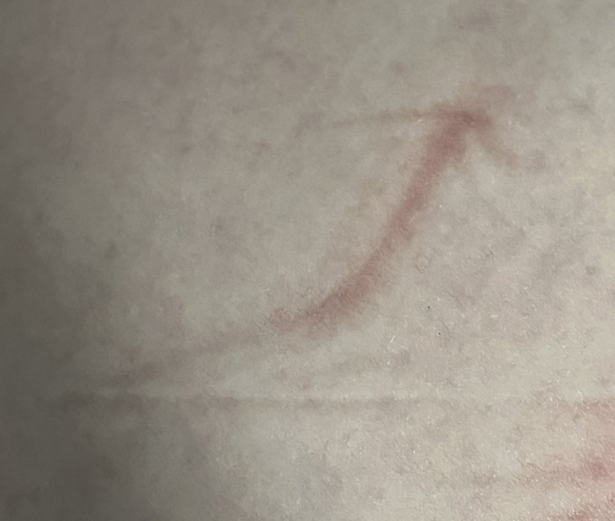 harley ˶ᵔ ᵕ ᵔ˶ tweet media