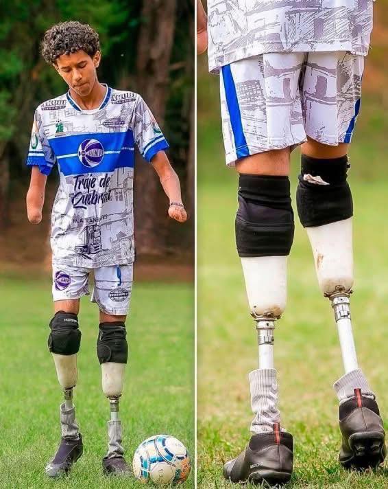 FootballFactly's tweet photo. His name is Esdras, a 13-year-old boy from São Paulo. He was born with malformations in his arms and without both legs, and uses prosthetic legs.
Despite his disability, he was never allowed to play, not even at school.

Three years ago, he found a local social football club, the Campo Belo Project.

The boy shows up to training sessions and matches every week. He finally made it, playing the sport he always dreamed of, alongside his friends.

There is no barrier to doing what we love. Esdras, a true fighter in life 🥹