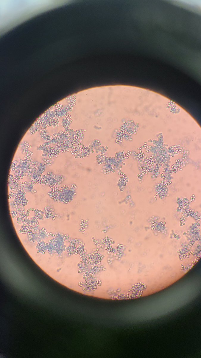 Hoshiko1_'s tweet photo. Awesome lab stuff from today. Holy moly I'm having fun with this stuff man 😭🙏🙏🙏. We had to dye some yeast in this blue chemical. It was fun. As for the 3rd picture I forgot the name of the organism we were looking at but it was cool af ✌️. 
#microscopeview https://t.co/EdoLHr4KDX