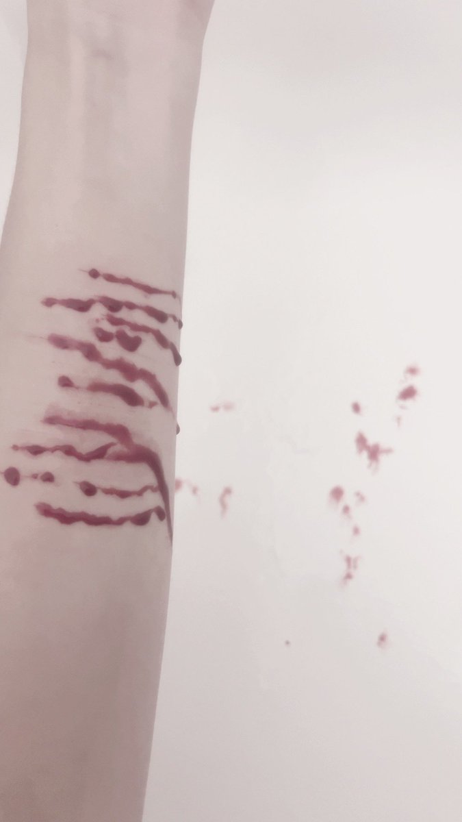 fruitdecay_'s tweet image. Am I good enough? 

#selfhate #selfharm