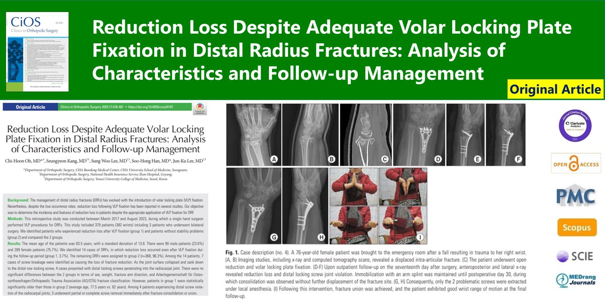 CiOSjournal's tweet image. Reduction Loss Despite Adequate Volar Locking Plate Fixation in Distal Radius Fractures: Analysis of Characteristics and Follow-up Management
🌷doi.org/10.4055/cios24…
17(3) Chi-Hoon Oh
#Distal_radius_fracture #Internal_fixation #Volar_locking_plate #Reduction_loss #Complication