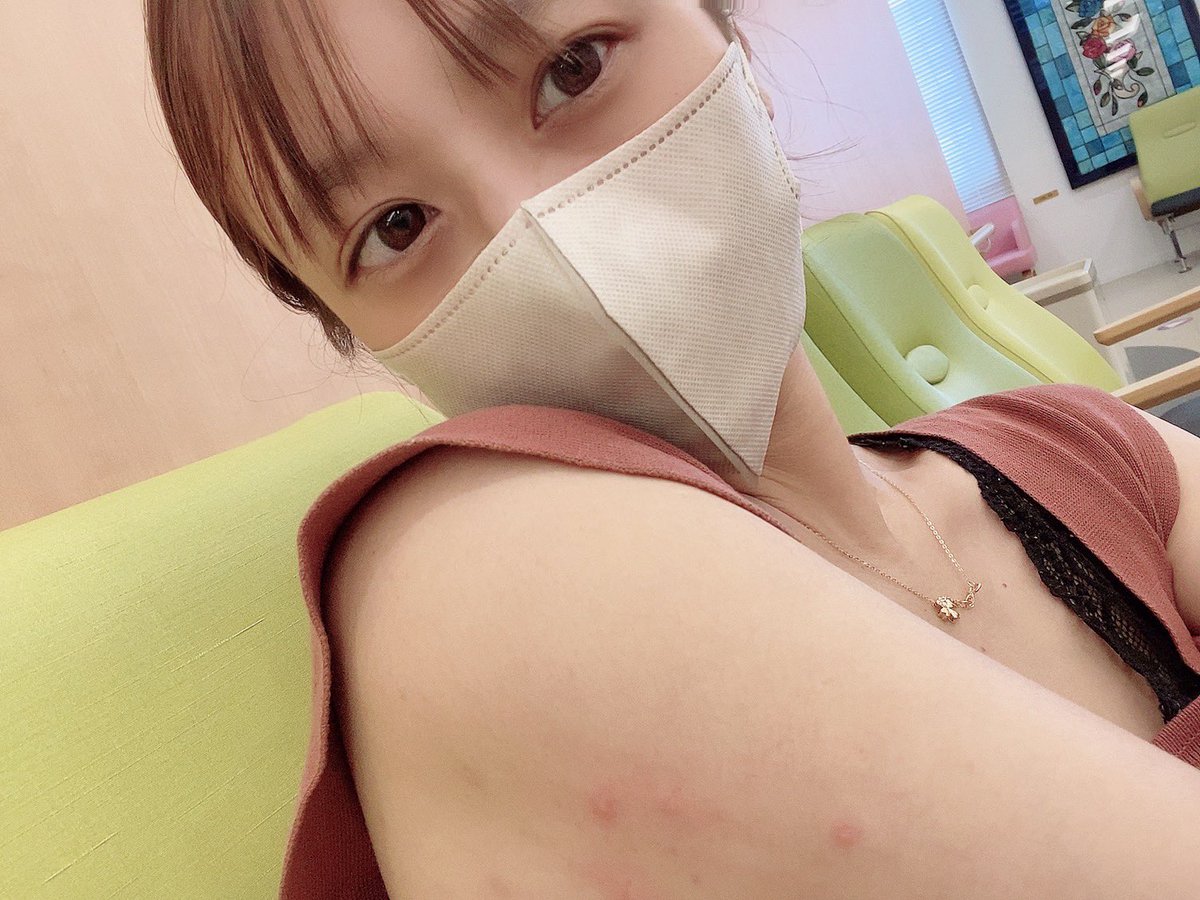 こういう湿疹が背中全体に大量発生😭

2週間前に病院行って薬もらったけど
薬切れたら再発、、、😭

そして大きな病院来たら
診察＆会計に3時間待ちでした😂
つかれた😂