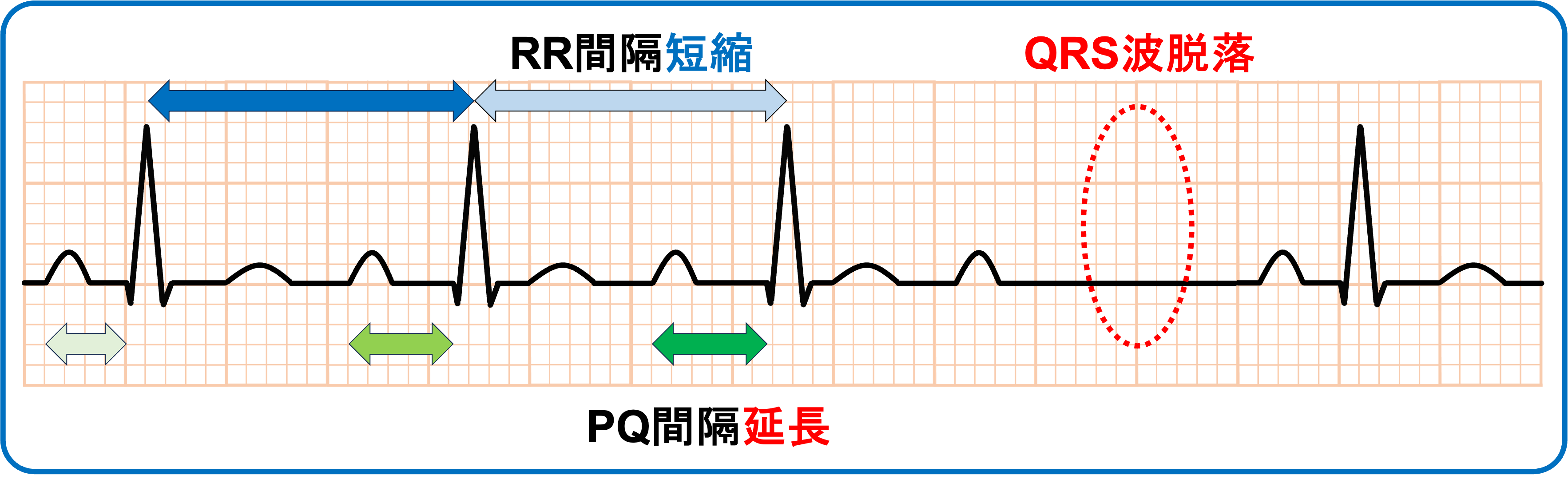 平波図(小)　K-001-2BR2-S Exmark LZ25KC604 S/N 190,000-219,999 (1999) Parts Diagram
