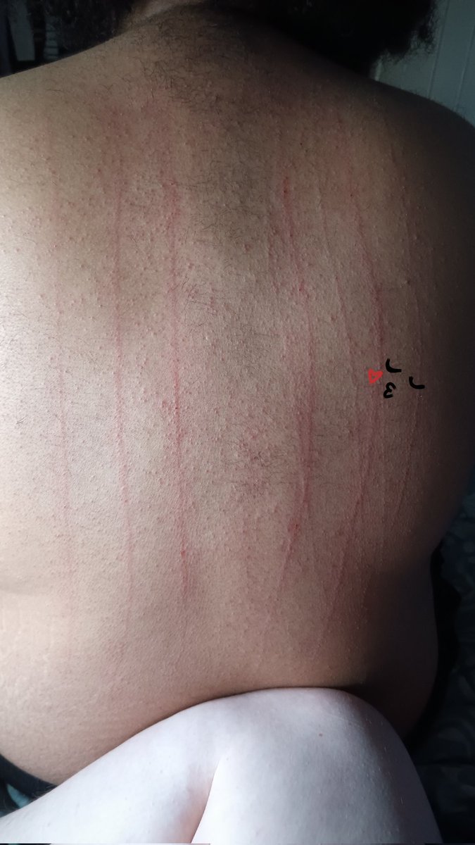 YourLilBuni's tweet photo. did I go too hard? (there was some blood)
#sadist #masochist https://t.co/4Z2Sl7XwFG