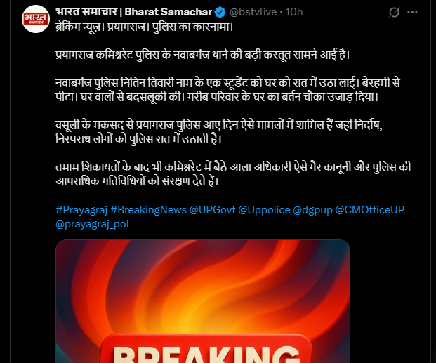 योगी जी, अब तो भारत समाचार पर भी एफआईआर बनती है।

भारत समाचार की ख़बर।

प्रयागराज पुलिस का कारनामा।

गरीब का चौका-बर्तन-घर उजाड़ा।
 
चूकिएगा नहीं योगी जी!

क्या पता मेरी ख़बर पर हटाया गया आपका मृत्युंजयी सलाहकार पेट में अपच के चलते लंबे समय तक दीर्घशंका निवारण में जुटा रह गया हो,