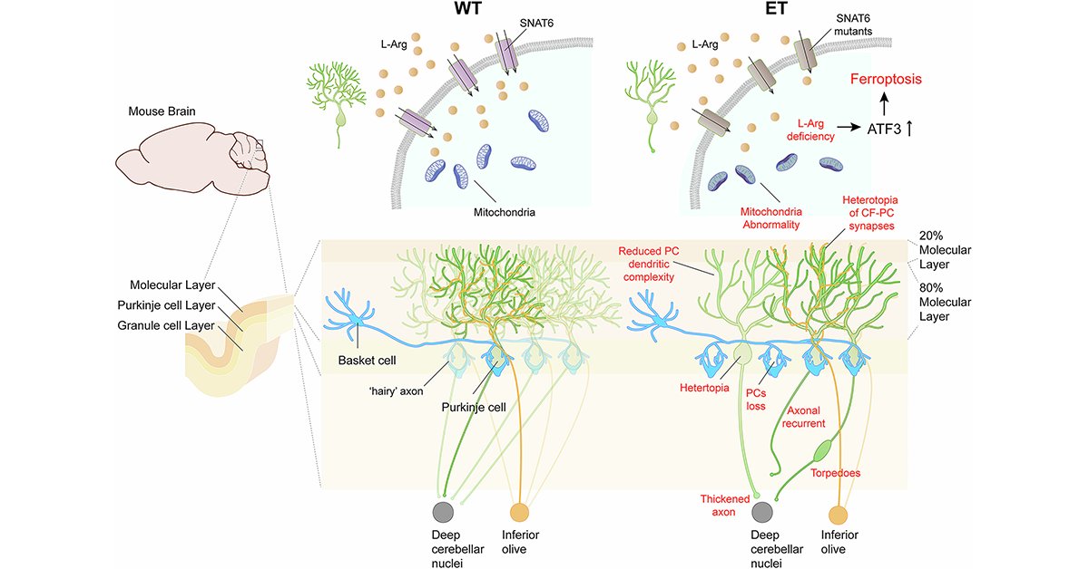sigtrans_sttt's tweet image. This study identified a SLC38A6 as a novel #EssentialTremor (ET)-associated gene and showed that SLC38A6 #LossOfFunction variants result in ET symptoms. @sjtu1896 @2024_HUST @CAS__Science 

#STTT #OpenAccess: doi.org/10.1038/s41392…