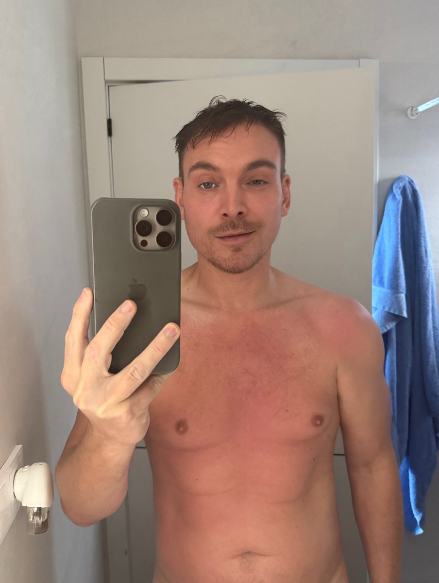 Doc_Scot's tweet image. Did it again … massage on the beach and the oil burnt me 🤦🏼‍♂️

When will I learn!