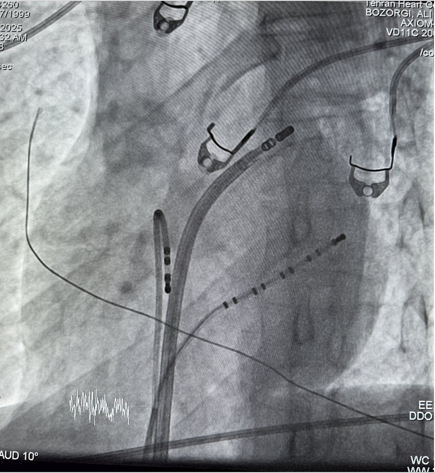 Ali Bozorgi tweet media