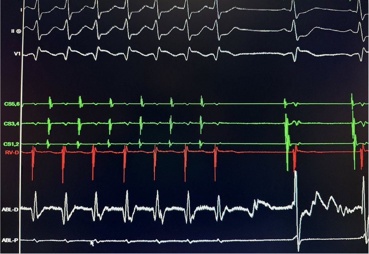 Ali Bozorgi tweet media