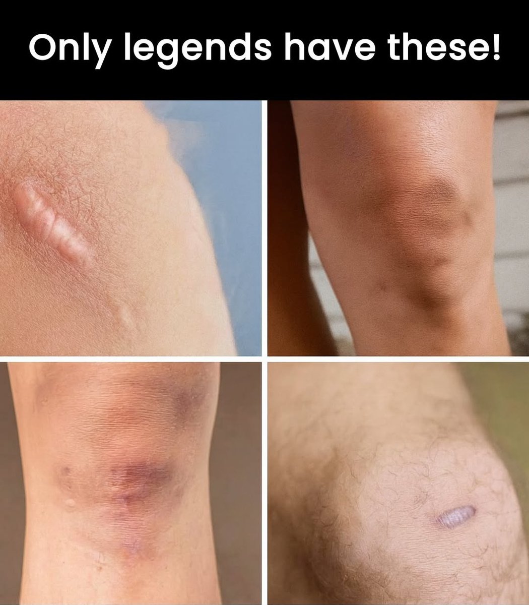 Memes_wallah_'s tweet image. Retweet if you are a legend