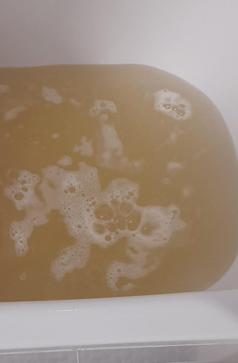 💧 El agua más cara de la historia de Badajoz llega sucia y sin presión a #CerroGordo.

👉 El PSOE, con nuestra portavoz <a href="/silgoncha/">Silvia González /♥️</a>, exige al alcalde soluciones inmediatas, transparencia e información clara como el agua para las familias afectadas.

#VamosConBadajoz #AguaDigna