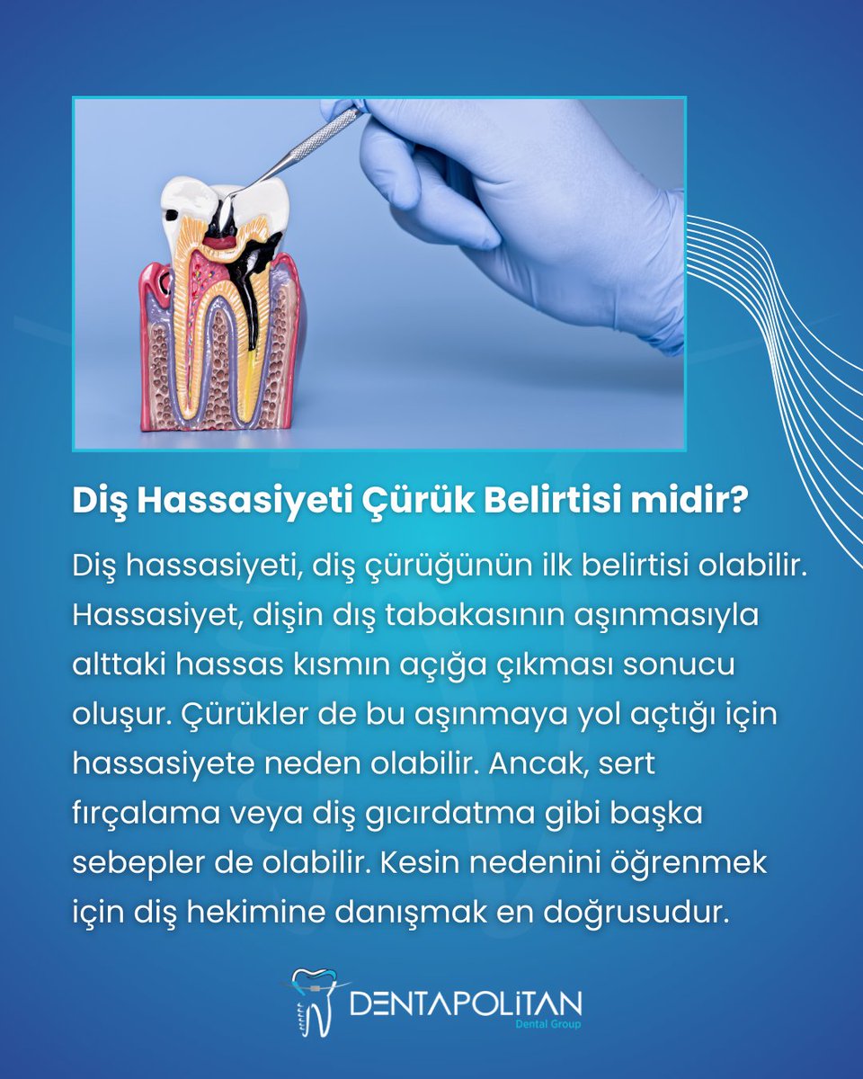 Sıcak, soğuk veya tatlı bir şeyler yediğinizde dişinizde ani bir sızı hissediyor musunuz? 😬 Bu, diş hassasiyeti olabilir! Çürüğün ilk belirtisi mi, yoksa başka bir nedeni mi var? Diş hekiminize danışın ve ağız sağlığınızı riske atmayın!

#DişÇürüğü #Dentapolitan
