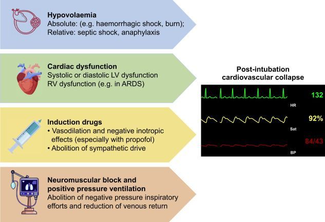 🫀 Haemodynamic collapse after ICU intubation: remember all the key mechanisms.
•Hypovolaemia
•LV/RV dysfunction
•Drug-induced vasodilation
•Transition to positive pressure ventilation
Optimise fluids &amp; vasopressors early.
#Airway #ICU 
👉  bjaed.org/article/S2058-…