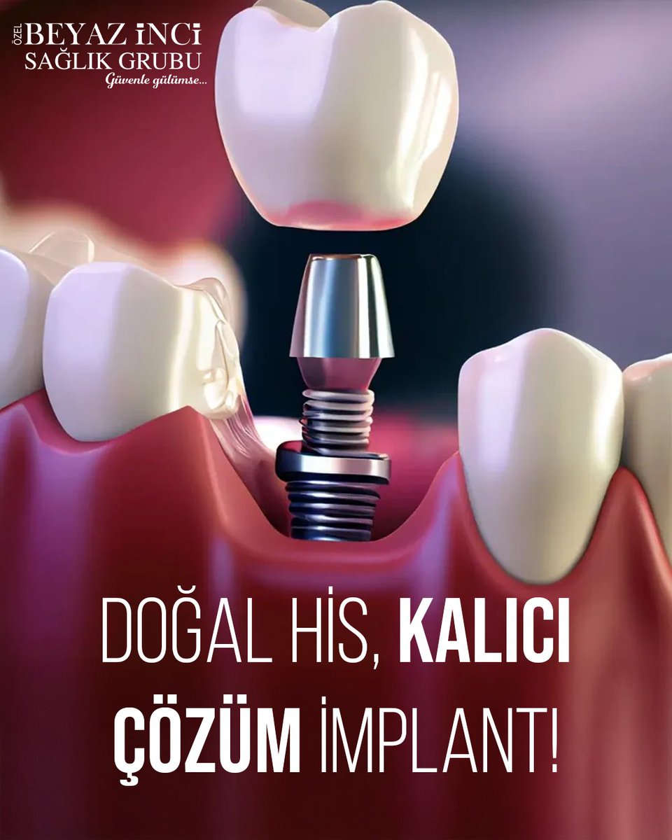 Kalıcı ve doğal gülüşler için implant tedavisini ertelemeyin!

📞 Randevu ve bilgi için:
📍 Bayramyeri: 0258 241 06 06
📍 Adalet: 0258 377 40 77
📍 Kınıklı: 0258 212 02 02
📍 Yenişafak: 0258 410 16 16