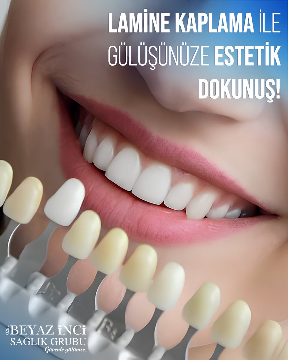 Gülüşünüzdeki küçük detaylarla büyük fark yaratın, estetiği ve doğallığı aynı anda yaşayın! 💙

📞 Randevu ve bilgi için:
📍 Bayramyeri: 0258 241 06 06
📍 Adalet: 0258 377 40 77
📍 Kınıklı: 0258 212 02 02
📍 Yenişafak: 0258 410 16 16