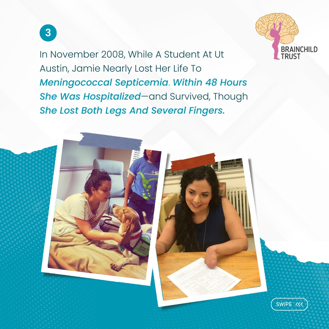 brainchildtrust's tweet photo. ✨ From Survivor to Advocate ✨
Meet Jamie Schanbaum — a true symbol of resilience, strength, and advocacy.

#SurvivorToAdvocate #JamieSchanbaum #BrainchildTrust #Resilience #AdvocacyInAction #MeningitisAwareness #VaccinesSaveLives #ParalympianSpirit #DisabilityAwareness https://t.co/jIfhPcHyVE