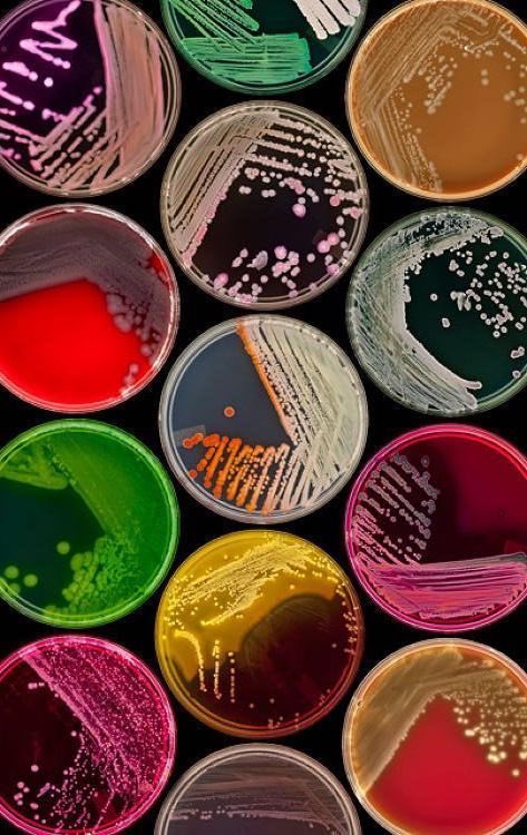 Manar_Alju's tweet image. أحب أتفرج على أطباق بتري والله فن 🧫