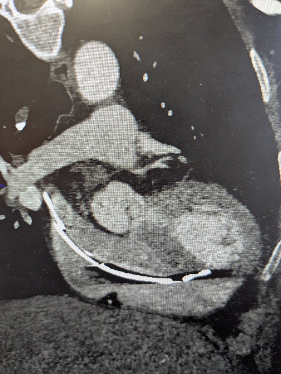 Cyrus Hadadi, MD tweet media