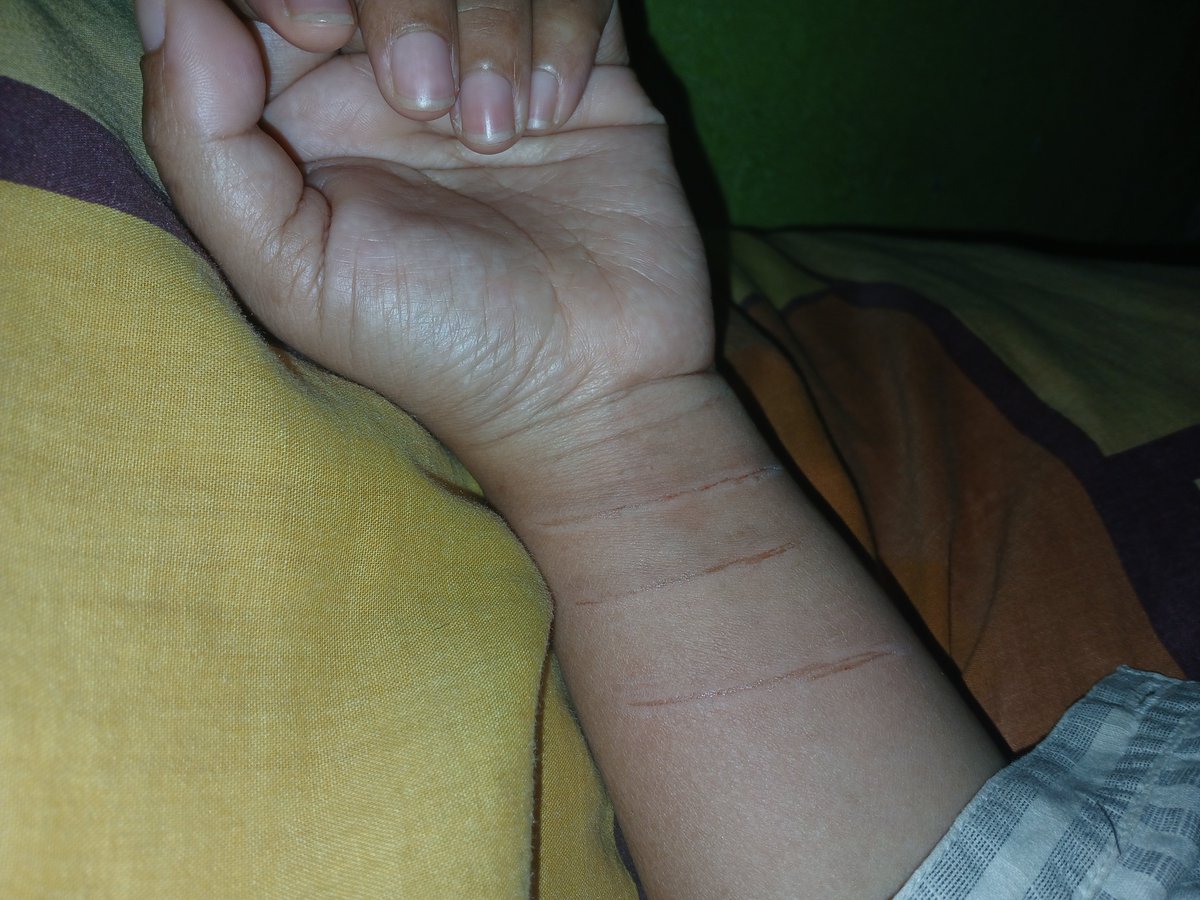 tatuismaia's tweet photo. ~Goresan~

Ada luka yg masih membekas
Karna wujudnya tak terlihat
Meskipun raganya bernafas
Tapi jiwanya tidak sehat

Hanya ada sisa goresan
Dalam setiap kenangan
Yang sulit untuk di lupakan
Apa masih bisa untuk bertahan? https://t.co/xt3AuiAcyS