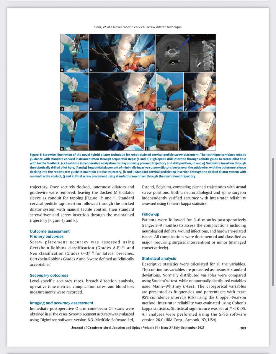 spinevidya's tweet photo. Breakthrough from MIRSS! 🚀 First-ever workflow combining robotics + MIS dilators for safe cervical pedicle screw placement.
✅ 98.7% accuracy
✅ 99.6% artery protection
A step toward safer, scalable robotic spine surgery.
#SpineSurgery #Robotics https://t.co/4E6be3sa1C