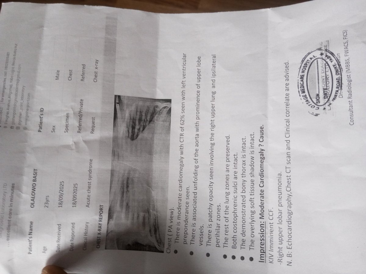 bazerro02's tweet image. Good morning everyone
This Is Basit(Bazerro)
Please, I need your help. to solicit for funds. I'm a sick cell patient and I got a blood transfusion some days ago and I've developed complications in my heart and body
Your tokens will go a long way everyone,🙏. Thank you so much
