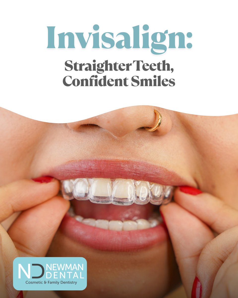 ddsdirk's tweet photo. Invisalign aligners make straightening your teeth simple and discreet. 😁

These clear aligners allow you to transform your smile without the inconvenience of braces. You can remove them to eat, brush, and floss—making them ideal for busy lifestyles. ✨ https://t.co/NR1Ub0fMor
