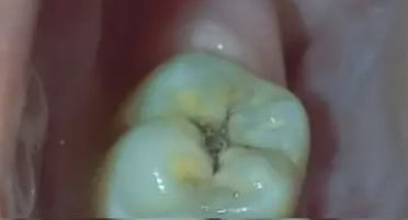 toothfairy tweet media
