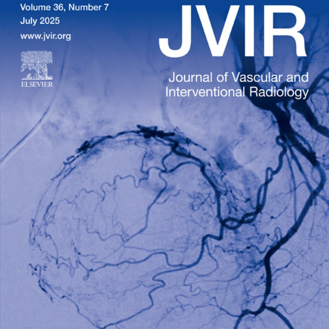 SIRspecialists's tweet image. Patients with #PAD and chronic kidney disease (CKD) Stage 5 had 4x higher amputation rates and 5x higher mortality compared with patients with PAD without CKD. Read the full clinical study in @JVIRmedia this #PADAwarenessMonth. brnw.ch/21wVSXI