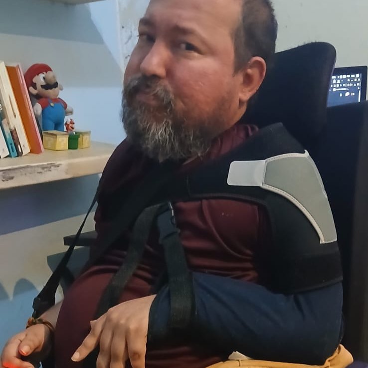 Estou com o ombro fraturado