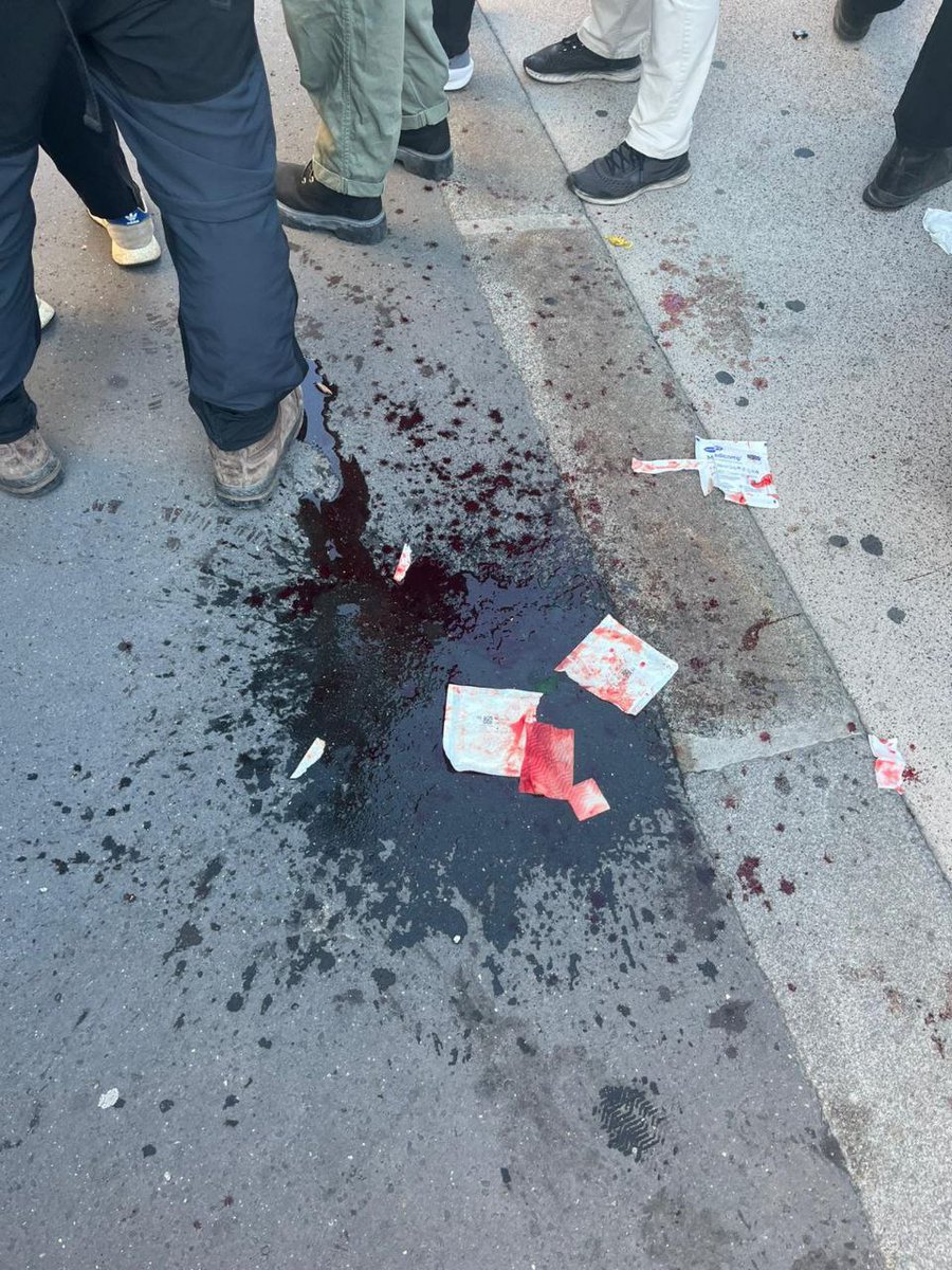 🔴 Un homme qui manifestait pacifiquement a le visage ensanglanté après s'être pris un tir de LBD dans le crâne, à Paris, Place de la Nation.