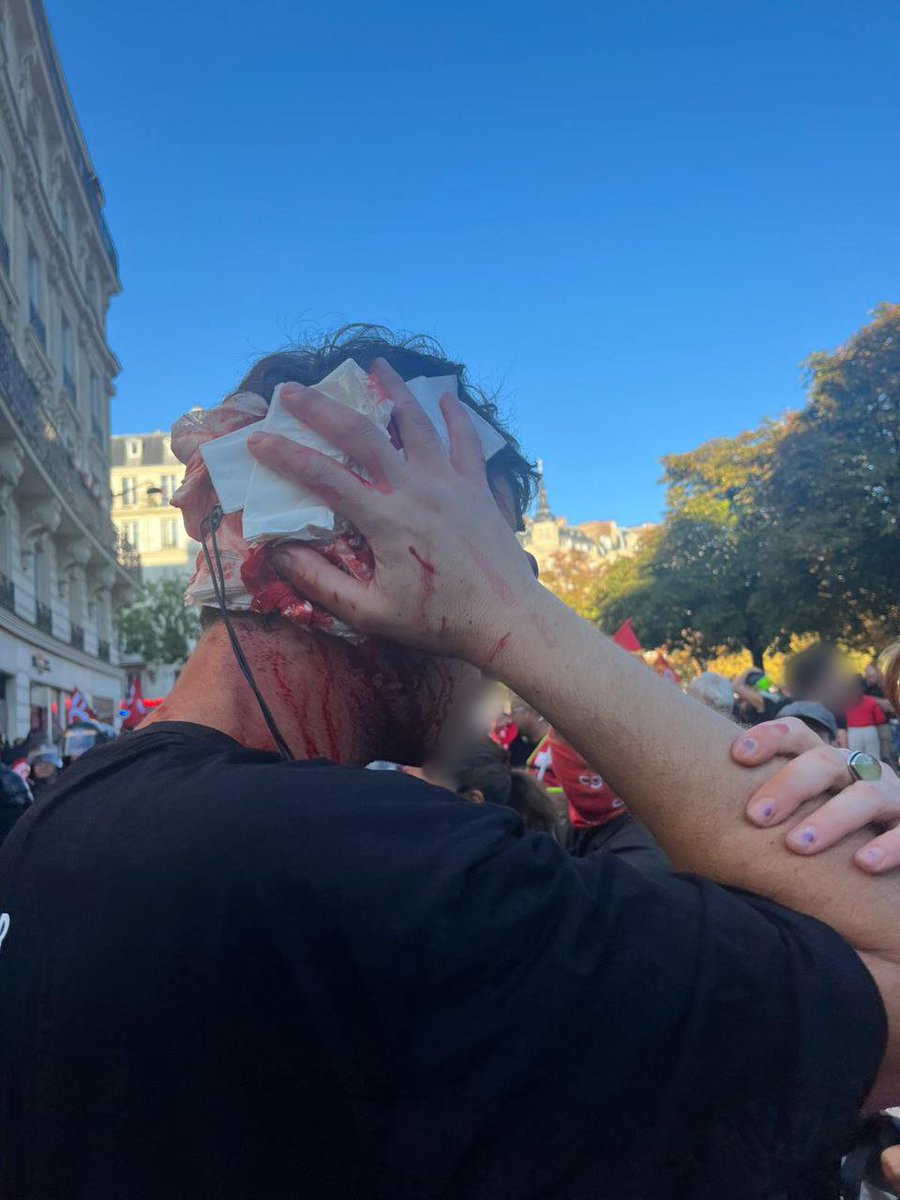 Glupatate's tweet photo. 🔴 Un homme qui manifestait pacifiquement a le visage ensanglanté après s'être pris un tir de LBD dans le crâne, à Paris, Place de la Nation. https://t.co/5lOPNf9ZF8