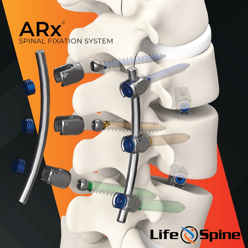 Life Spine, Inc. tweet media