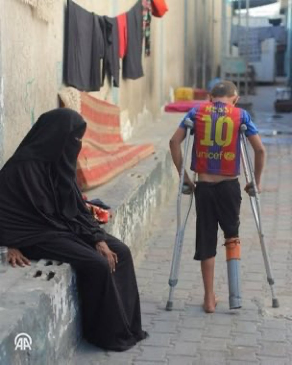 اسرائيل الارهابية بترت قدمه وحرقت قلب امه