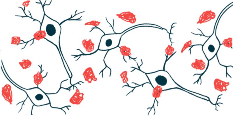 Researchers have shed light on how small alpha-synuclein clumps disrupt brain cell membranes by forming pores in Parkinson’s disease. buff.ly/xGAt5UP
