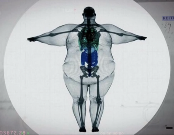stepituppp's tweet photo. If you have 20 or more pounds of fat to lose in 2025, read this: https://t.co/VA7ldVv5qx