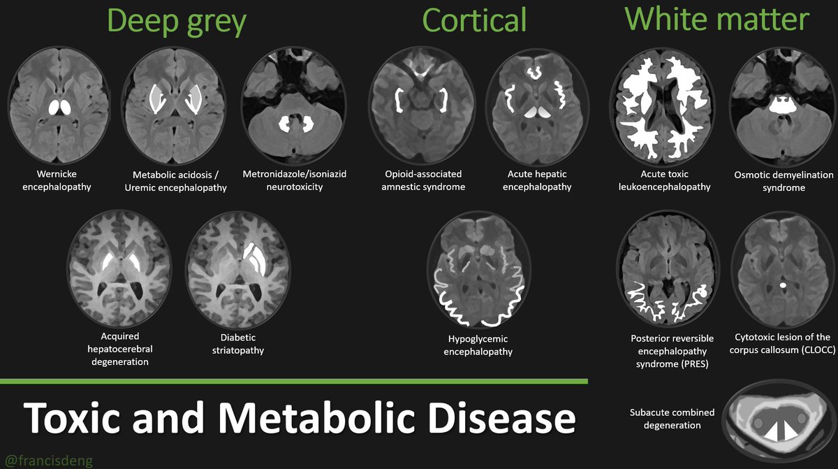 Characteristic imaging patterns in toxic and acquired metabolic disorders of the central nervous system (schematic)
🧠🤮💊🫗